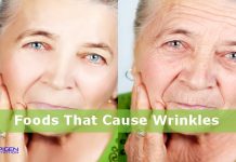 Foods that cause wrinkles