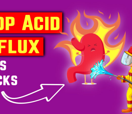 stop acid reflux